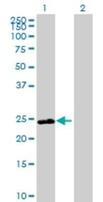 Western Blot: DNAJB8 Antibody [H00165721-B01P]