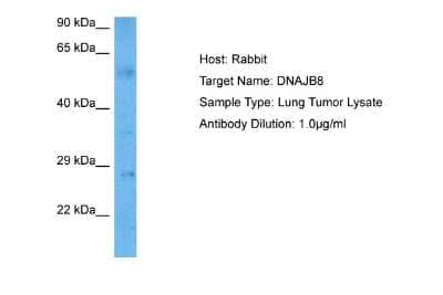 Western Blot: DNAJB8 Antibody [NBP2-84007]