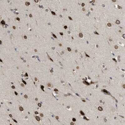 Immunohistochemistry-Paraffin: DNAJC1 Antibody [NBP1-85002]
