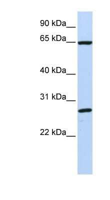 Western Blot: DNAJC1 Antibody [NBP1-62602]