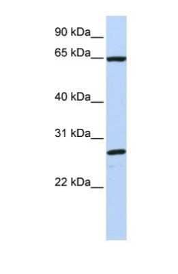 Western Blot: DNAJC1 Antibody [NBP1-69608]