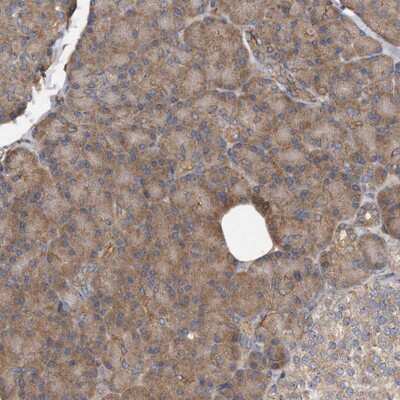 Immunohistochemistry-Paraffin: DNAJC10 Antibody [NBP1-83965]