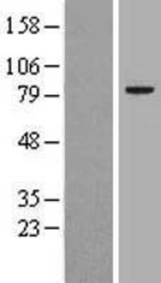 Western Blot: DNAJC10 Overexpression Lysate [NBL1-09944]