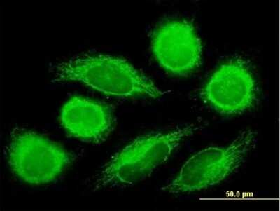 Immunocytochemistry/ Immunofluorescence: DNAJC11 Antibody [H00055735-B01P]