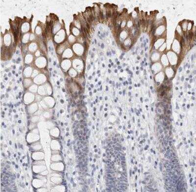 Immunohistochemistry-Paraffin: DNAJC11 Antibody [NBP1-83834]