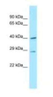 Western Blot: DNAJC11 Antibody [NBP1-98430]