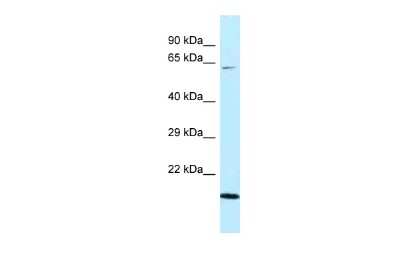 Western Blot: DNAJC11 Antibody [NBP2-87287]