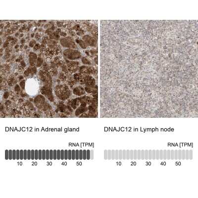 Immunohistochemistry-Paraffin: DNAJC12 Antibody [NBP1-83083]
