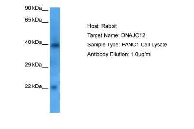 Western Blot: DNAJC12 Antibody [NBP2-84803]