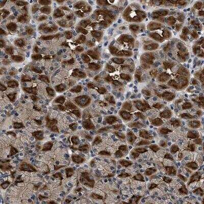 Immunohistochemistry-Paraffin: DNAJC14 Antibody [NBP1-90488]