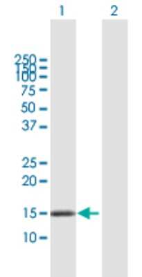 Western Blot: DNAJC15 Antibody [H00029103-B01P]