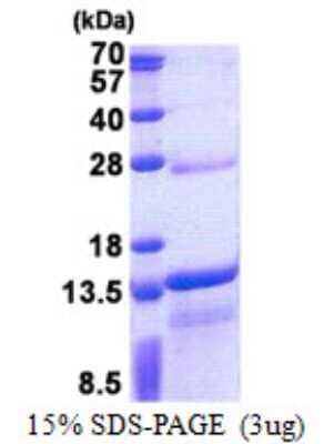 SDS-PAGE: Recombinant Human DNAJC15 His Protein [NBP2-23006]