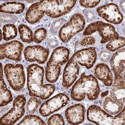 Immunohistochemistry-Paraffin: DNAJC16 Antibody [NBP1-81454]