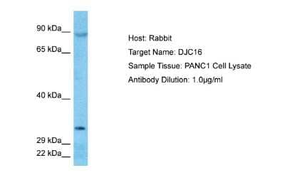 Western Blot: DNAJC16 Antibody [NBP2-82900]