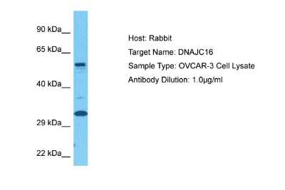 Western Blot: DNAJC16 Antibody [NBP2-82901]
