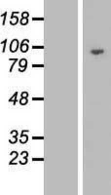 Western Blot: DNAJC16 Overexpression Lysate [NBL1-09947]