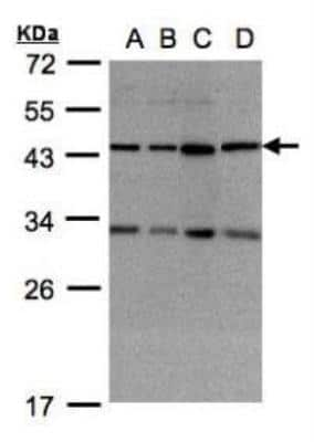 Western Blot: DNAJC17 Antibody [NBP1-32472]