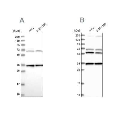 Western Blot: DNAJC17 Antibody [NBP1-84613]