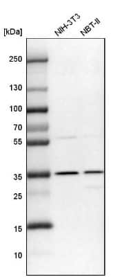 Western Blot: DNAJC17 Antibody [NBP1-84614]