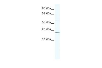 Western Blot: DNAJC17 Antibody [NBP2-87289]