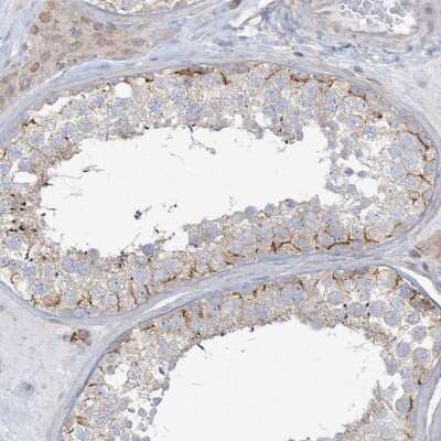 Immunohistochemistry-Paraffin: DNAJC18 Antibody [NBP1-81137]