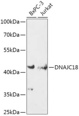 Western Blot: DNAJC18 AntibodyAzide and BSA Free [NBP2-92387]