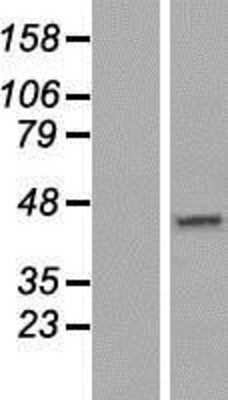 Western Blot: DNAJC18 Overexpression Lysate [NBP2-05323]