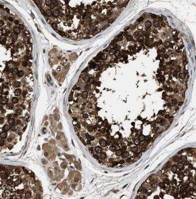 Immunohistochemistry-Paraffin: DNAJC2 Antibody [NBP1-82627]