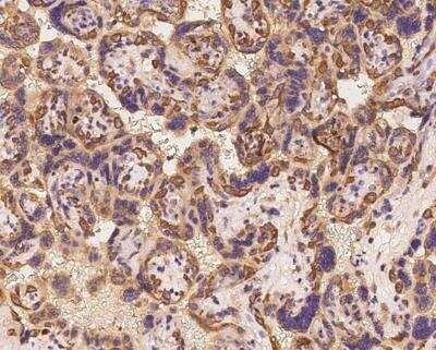 Immunohistochemistry-Paraffin: DNAJC2 Antibody [NBP3-12630]
