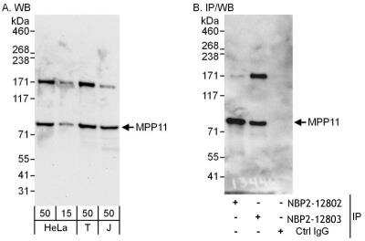 Immunoprecipitation: DNAJC2 Antibody [NBP2-12803]