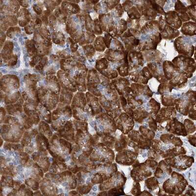 Immunohistochemistry-Paraffin: DNAJC21 Antibody [NBP1-85003]
