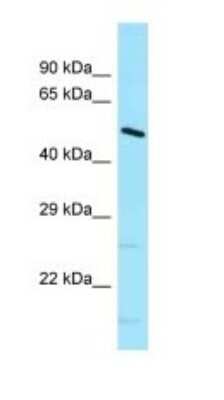 Western Blot: DNAJC21 Antibody [NBP1-98432]