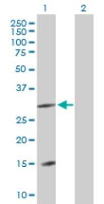 Western Blot: DNAJC22 Antibody [H00079962-B01P]