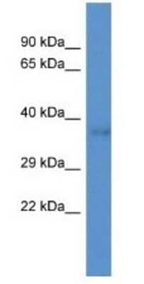 Western Blot: DNAJC22 Antibody [NBP1-79328]