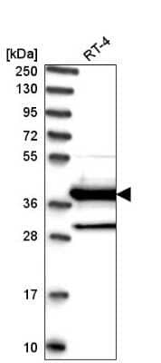 Western Blot: DNAJC22 Antibody [NBP2-58463]