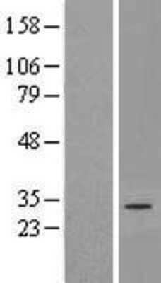 Western Blot: DNAJC22 Overexpression Lysate [NBP2-06271]