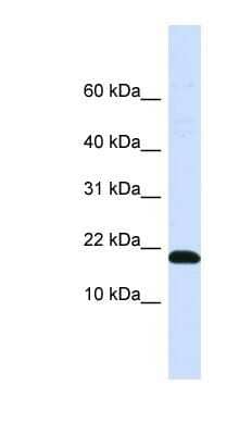 Western Blot: DNAJC25-GNG10 Antibody [NBP1-91558]