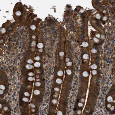 Immunohistochemistry-Paraffin: DNAJC28 Antibody [NBP1-88273]