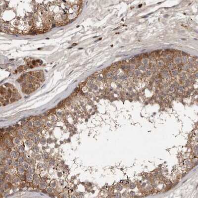 Immunohistochemistry-Paraffin: DNAJC28 Antibody [NBP1-88274]