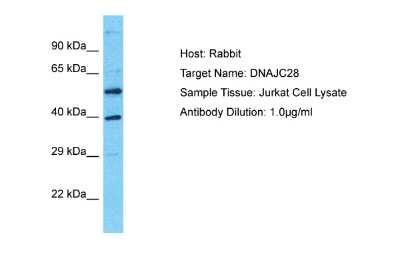 Western Blot: DNAJC28 Antibody [NBP2-84806]