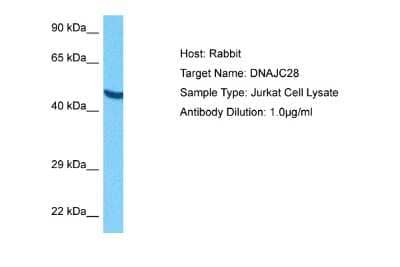 Western Blot: DNAJC28 Antibody [NBP2-84807]