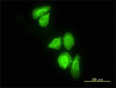 Immunocytochemistry/ Immunofluorescence: DNAJC3 Antibody (4D3-F2) [H00005611-M01]