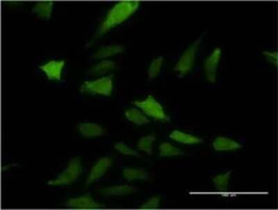 Immunocytochemistry/ Immunofluorescence: DNAJC3 Antibody (S2) [H00005611-M03]