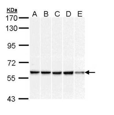 Western Blot: DNAJC3 Antibody [NBP1-33393]