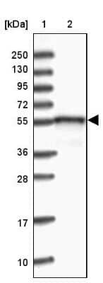 Western Blot: DNAJC3 Antibody [NBP2-48704]