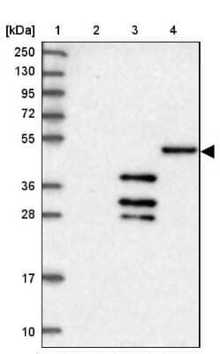 Western Blot: DNAJC3 Antibody [NBP2-48734]