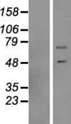 Western Blot: DNAJC3 Overexpression Lysate [NBP2-07649]