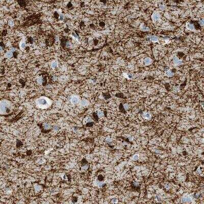 Immunohistochemistry-Paraffin: DNAJC30 Antibody [NBP1-80621]