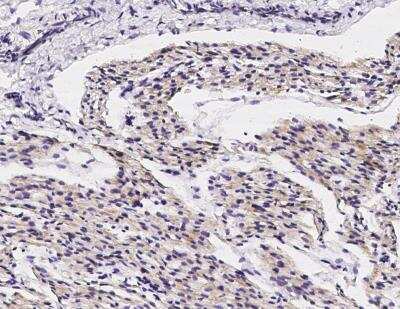 Immunohistochemistry-Paraffin: DNAJC30 Antibody [NBP3-12538]