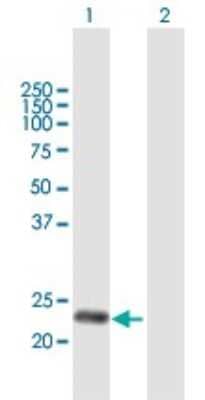 Western Blot: DNAJC30 Antibody [H00084277-B01P]